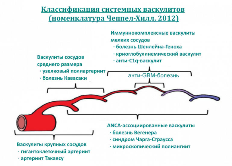 Классификация системных васкулитов