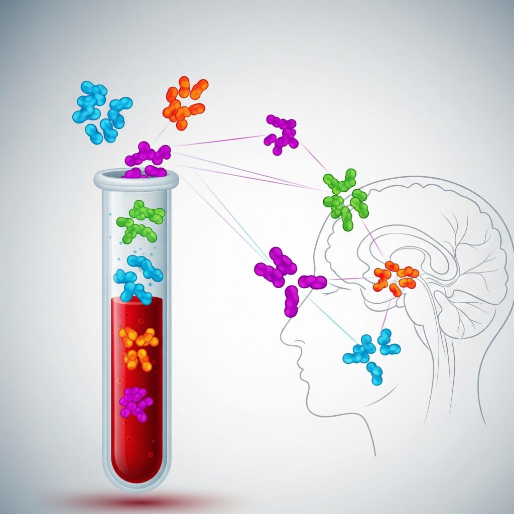 Комплексная диагностика рассеянного склероза (олигоклональные иммуноглобулины G и свободные легкие цепи в цереброспинальной жидкости)