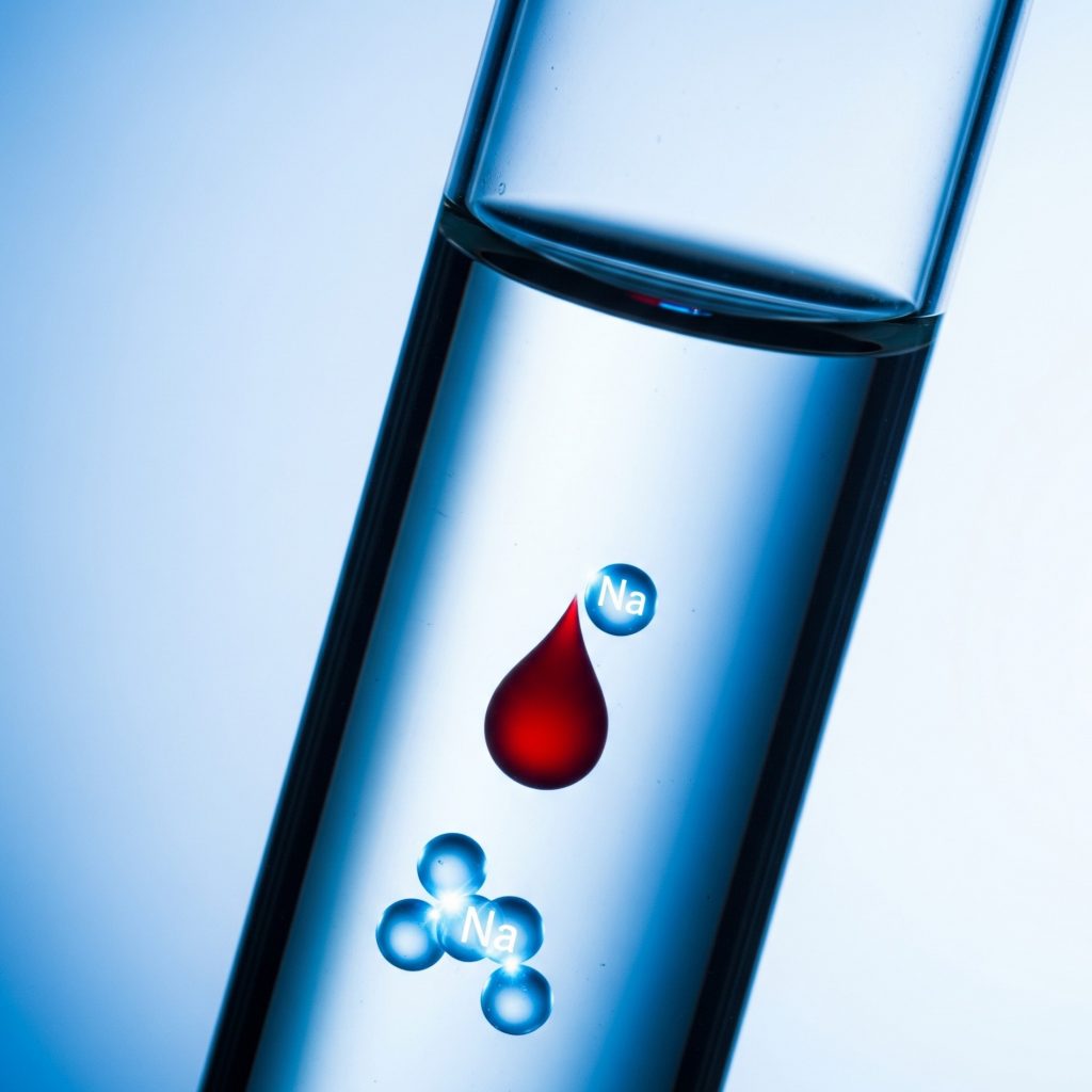 Натрий в сыворотке