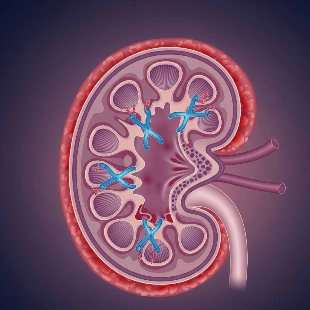 Обследование при волчаночном нефрите
